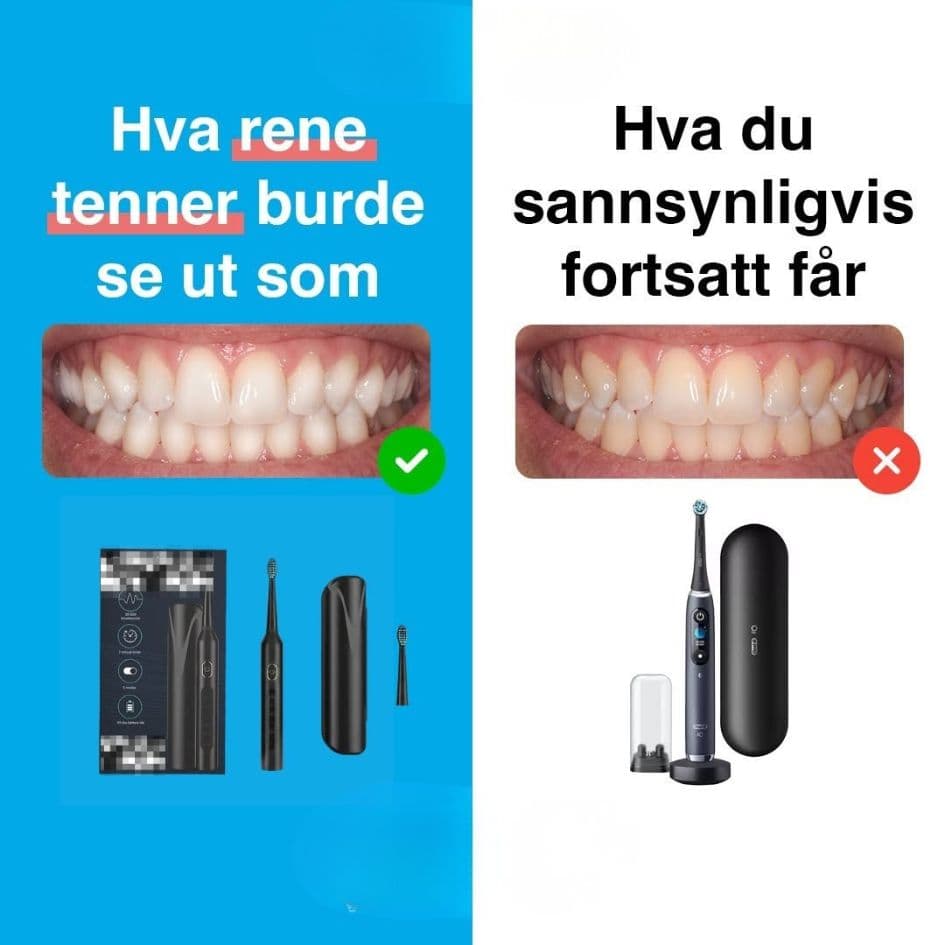 Annonse delt i to: hvordan rene tenner burde se ut mot hvordan de ofte ser ut.